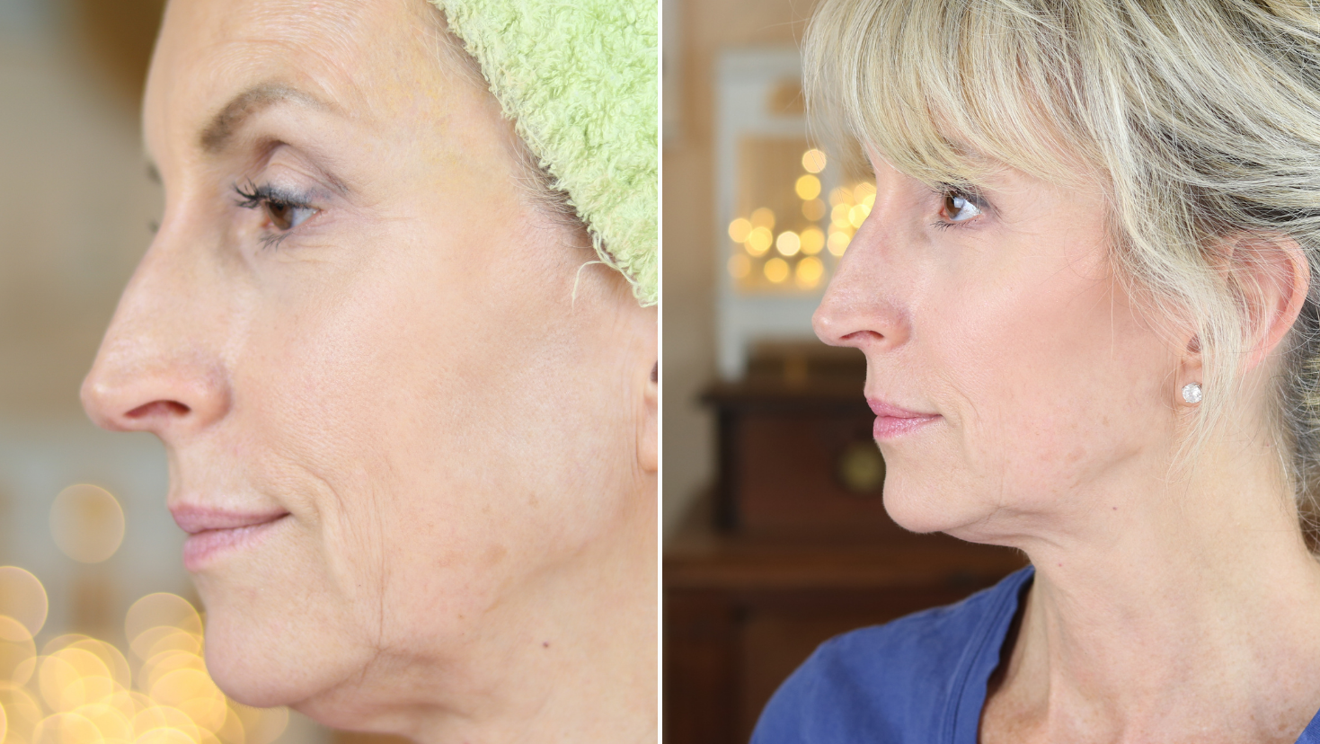 The Best Skincare for Menopausal Skin - EVENSKYN®