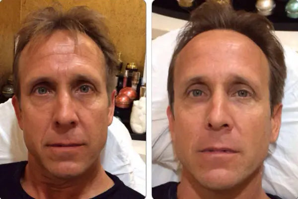 Maximise Your Red Light Therapy Results: Top Budget-Friendly Skincare Products - EVENSKYN®