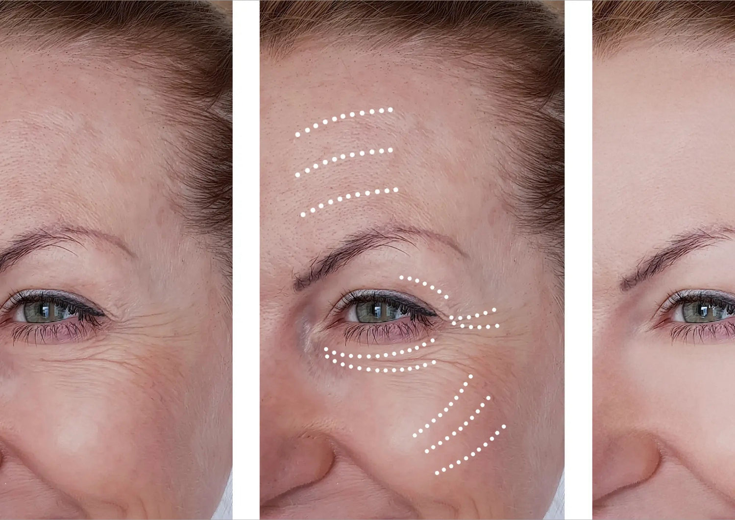 The Anti-Aging “Secret” Dermatologists Use—Now Possible at Home - EVENSKYN®
