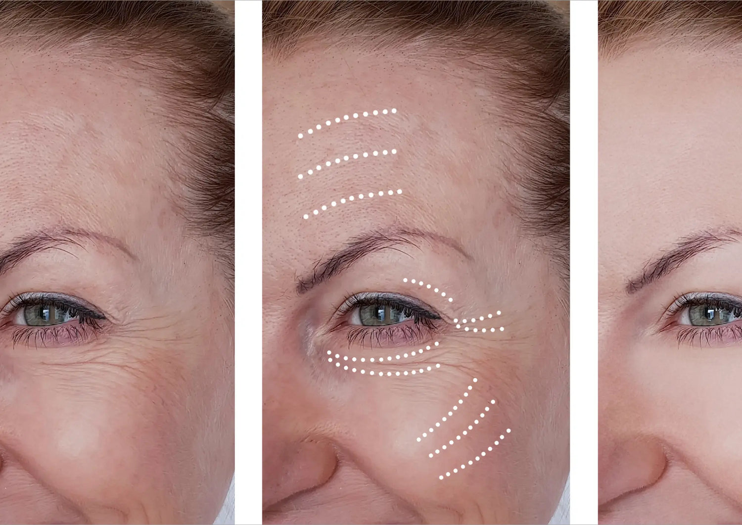 The-Anti-Aging-Secret-Dermatologists-Use-Now-Possible-at-Home EVENSKYN®