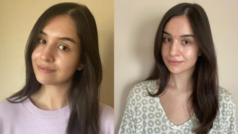 Radiant Skin from the Comfort of Home: The Benefits of At-Home Red Light Therapy - EVENSKYN® Radiant Skin from the Comfort of Home: The Benefits of At-Home Red Light Therapy - EVENSKYN®