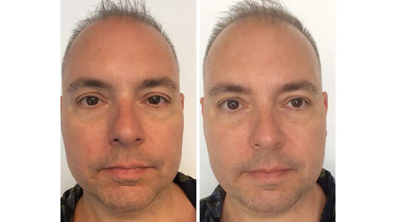 Achieving Professional Results with Microcurrent At-Home - EVENSKYN® Achieving Professional Results with Microcurrent At-Home - EVENSKYN®