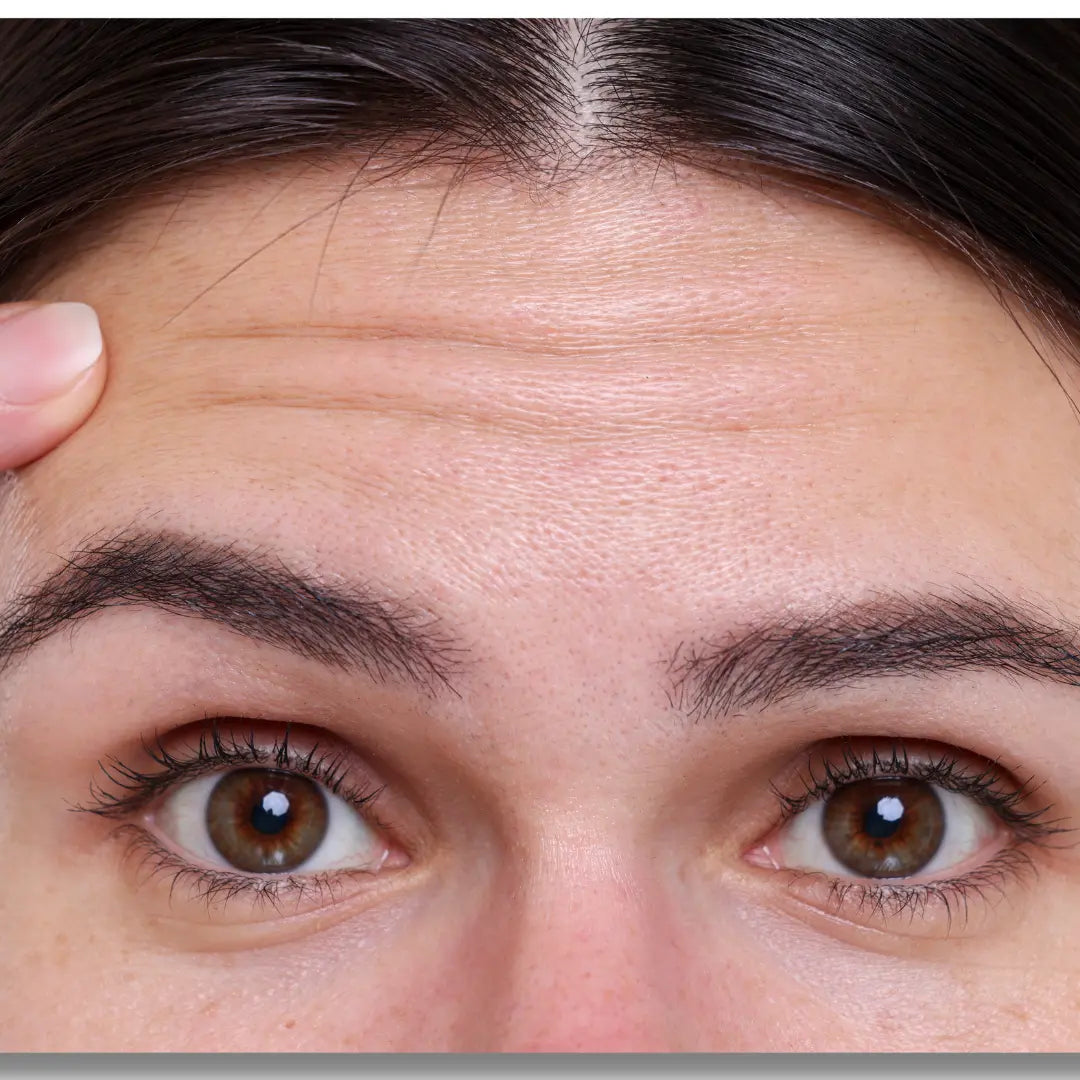 The Benefits of Doing RF Skin Tightening & Microcurrent Lifting At Home - EVENSKYN®