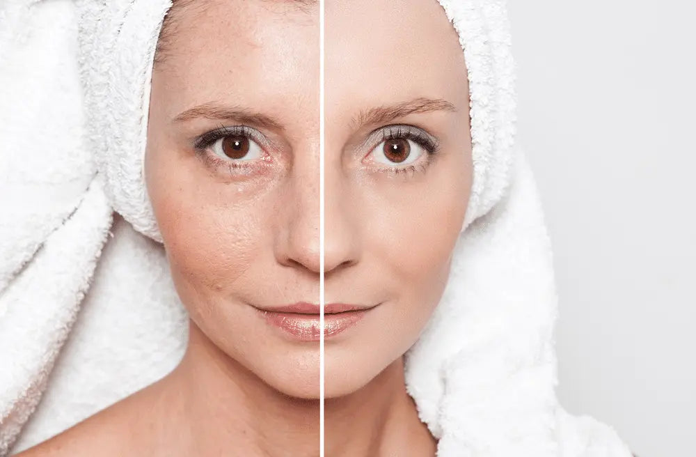 DIY Radiofrequency (RF) Skin Tightening: The Latest Techniques - EVENSKYN® DIY Radiofrequency (RF) Skin Tightening: The Latest Techniques - EVENSKYN®