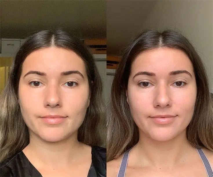 Red Light Therapy for Neck and Chest Tightening at Home - EVENSKYN®