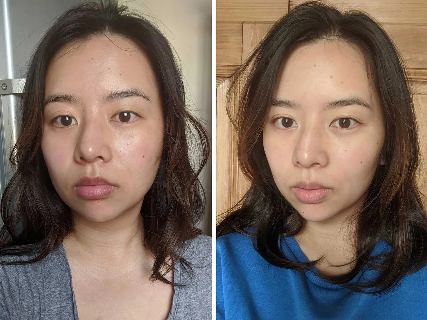 Maximizing Microcurrent Results with Professional Tips for Home Use - EVENSKYN®