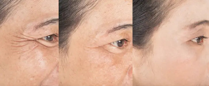 The Best Budget Skincare Products to Use with Red Light Therapy for Wrinkles - EVENSKYN® The Best Budget Skincare Products to Use with Red Light Therapy for Wrinkles - EVENSKYN®