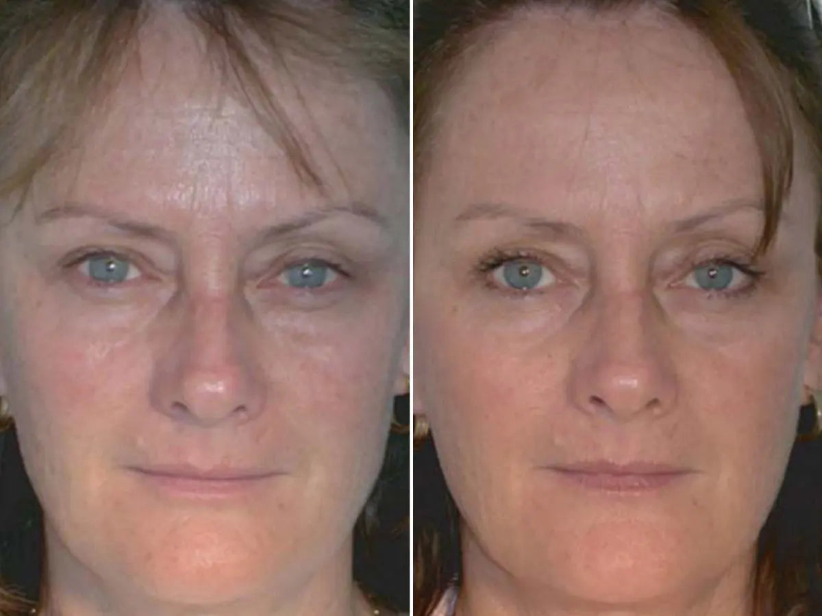 The Glowing Magic: Red Light Therapy's Role in Transforming Aging Skin at Home - EVENSKYN® The Glowing Magic: Red Light Therapy's Role in Transforming Aging Skin at Home - EVENSKYN®