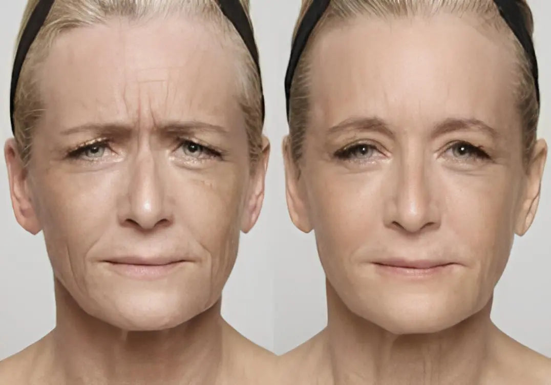 Affordable Skincare Tools for Wrinkle Reduction: A Complete At-Home Guide - EVENSKYN®