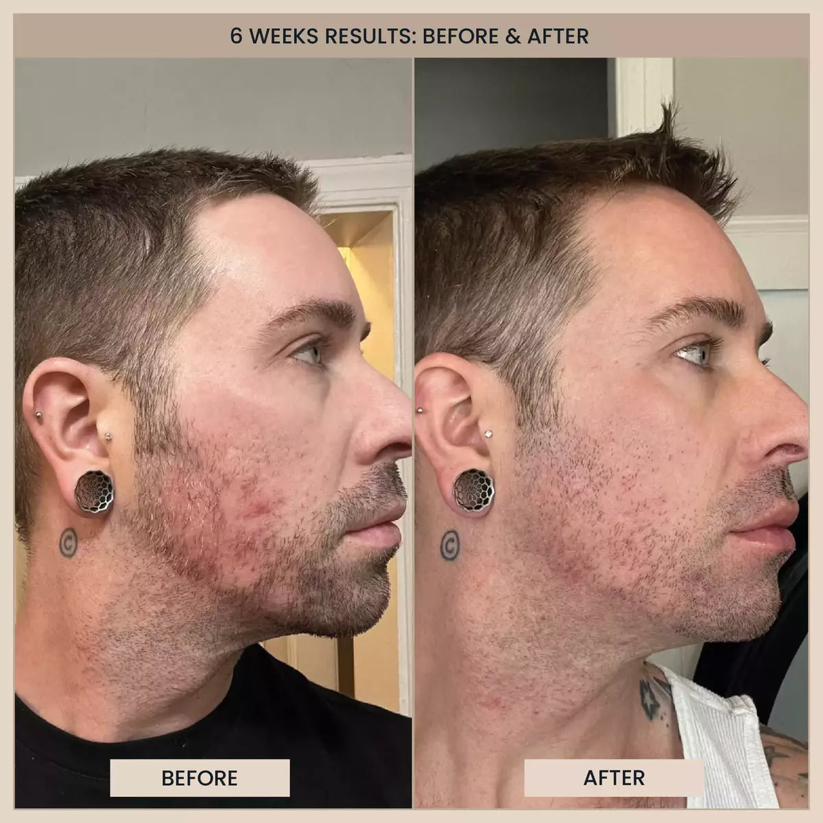 Block image Block image