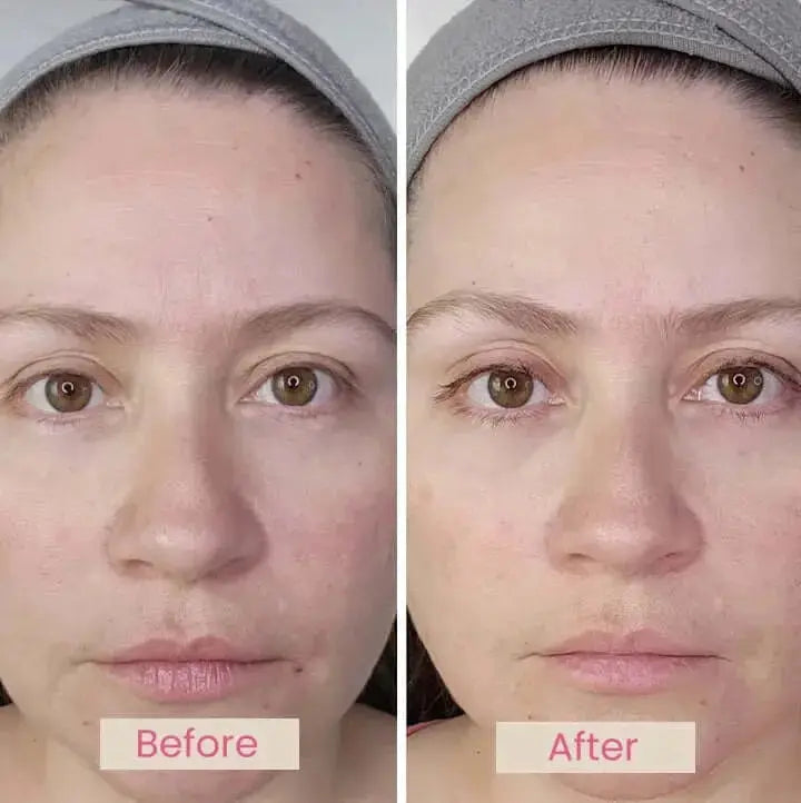EvenSkyn® Mirage: Professional LED Phototherapy Face Mask EvenSkyn® Beauty Solutions EvenSkyn® Mirage: Professional LED Phototherapy Face Mask EvenSkyn® Beauty Solutions