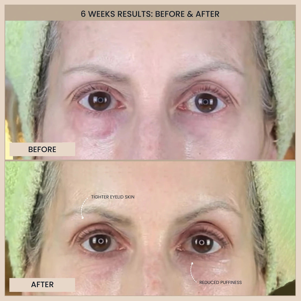 Block image Block image