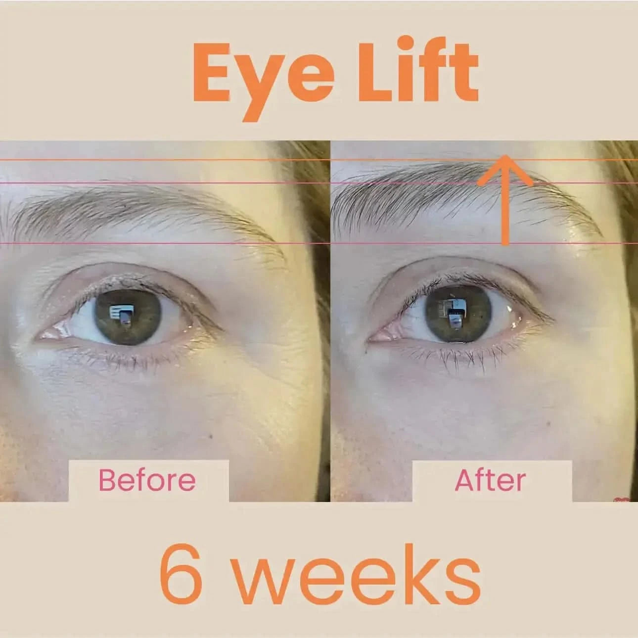 EvenSkyn® Venus: Advanced Eyelid Anti-Aging Device EvenSkyn® Beauty Solutions EvenSkyn® Venus: Advanced Eyelid Anti-Aging Device EvenSkyn® Beauty Solutions