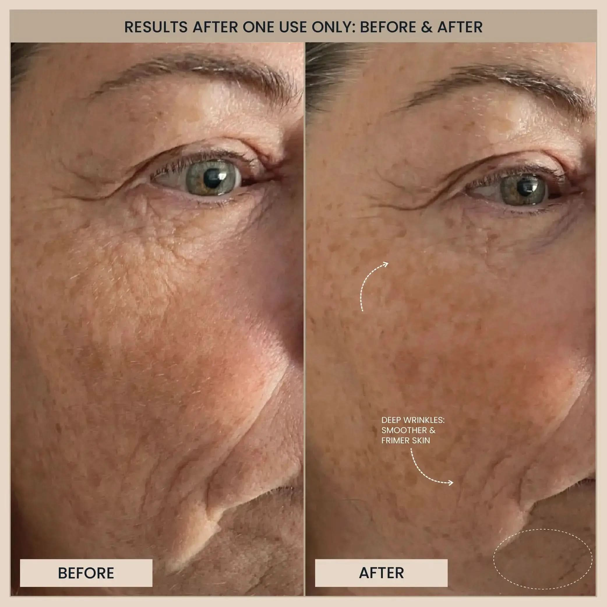 Jen_C_Before_After Jen_C_Before_After