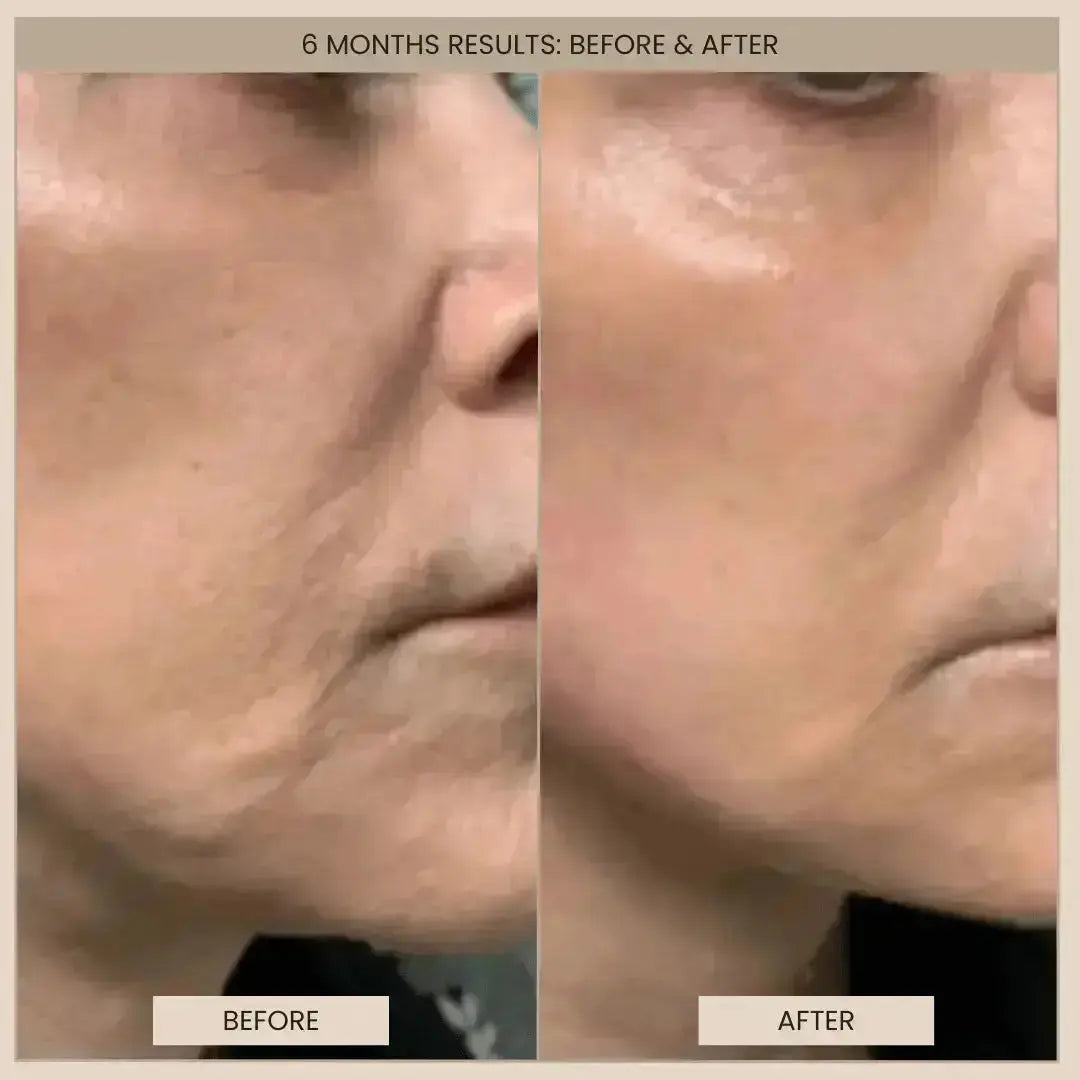 Lumo_Before_After Lumo_Before_After