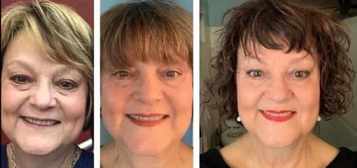 Kim Z.’s own before and after, from a review of the Lumo+ and Venus