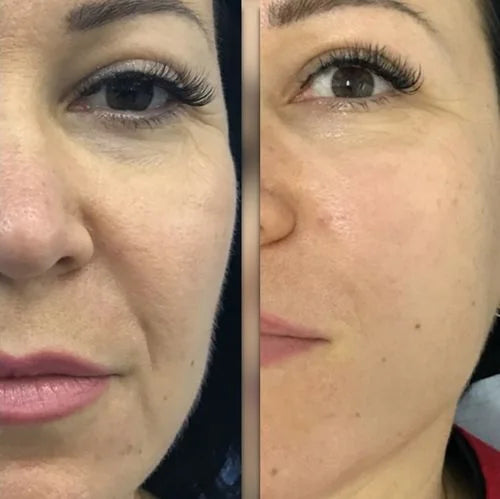 Michelle R.’s own before and after, from a review of the Original Lumo