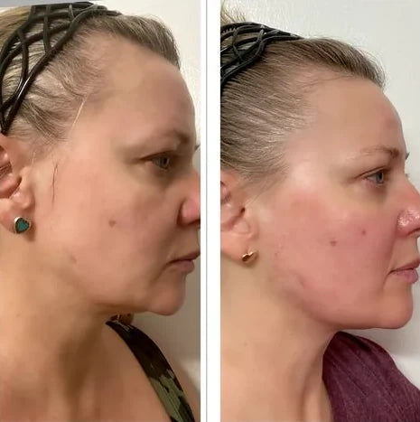 Eve K.’s own before and after, from a review of the Original Lumo