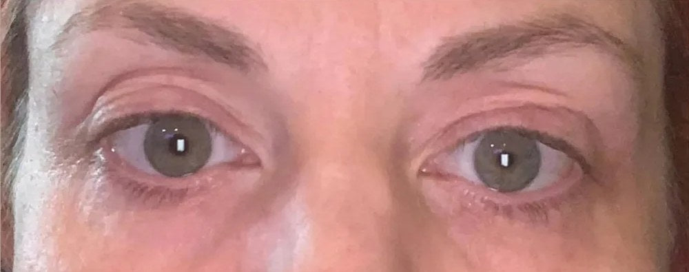 After 3 weeks with the Venus: a woman’s eyes