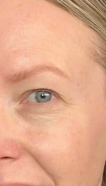 Before using the Venus: a woman’s eye area