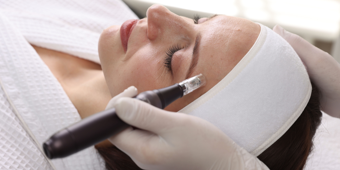 Microneedling Pen vs Stamp vs Roller vs Micro-Infusion at Home: Depth, Sterility, Serum and Cost Compared (2026)