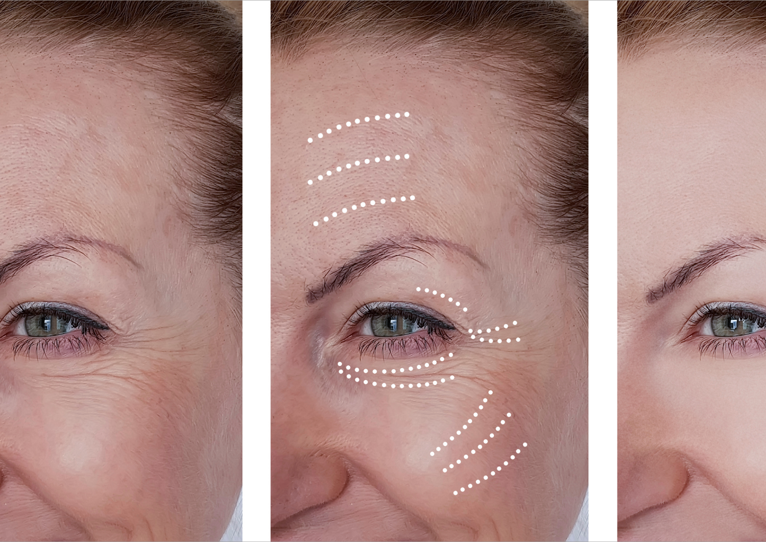 The Anti-Aging “Secret” Dermatologists Use—Now Possible at Home