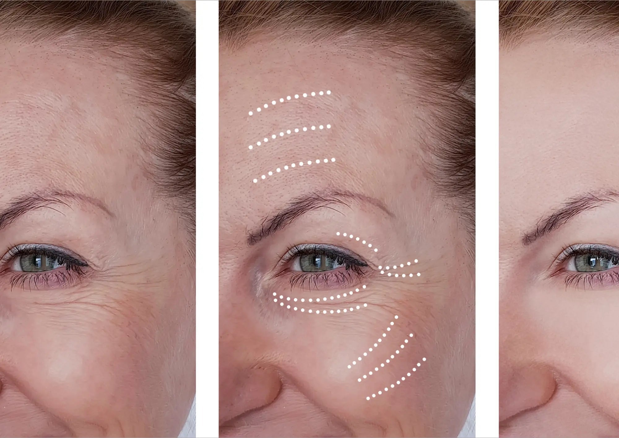 The Anti-Aging “Secret” Dermatologists Use—Now Possible at Home - EVENSKYN® 