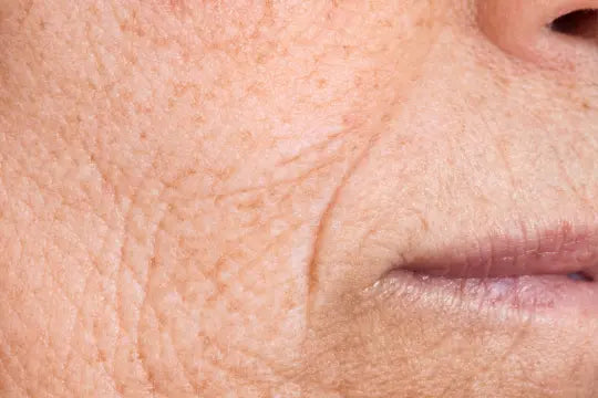 Rediscover-Youthful-Skin-Naturally-A-Comprehensive-Guide-to-Anti-Aging-Techniques EVENSKYN®