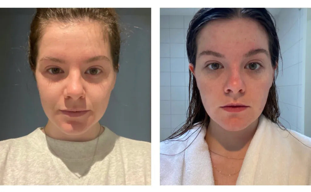 EMS Facial Toning: A Revolutionary Approach to Ageless Skin