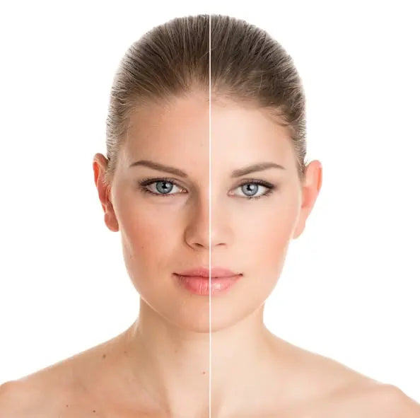 Microcurrent-for-Men-A-Guide-to-At-Home-Skin-Rejuvenation EVENSKYN®