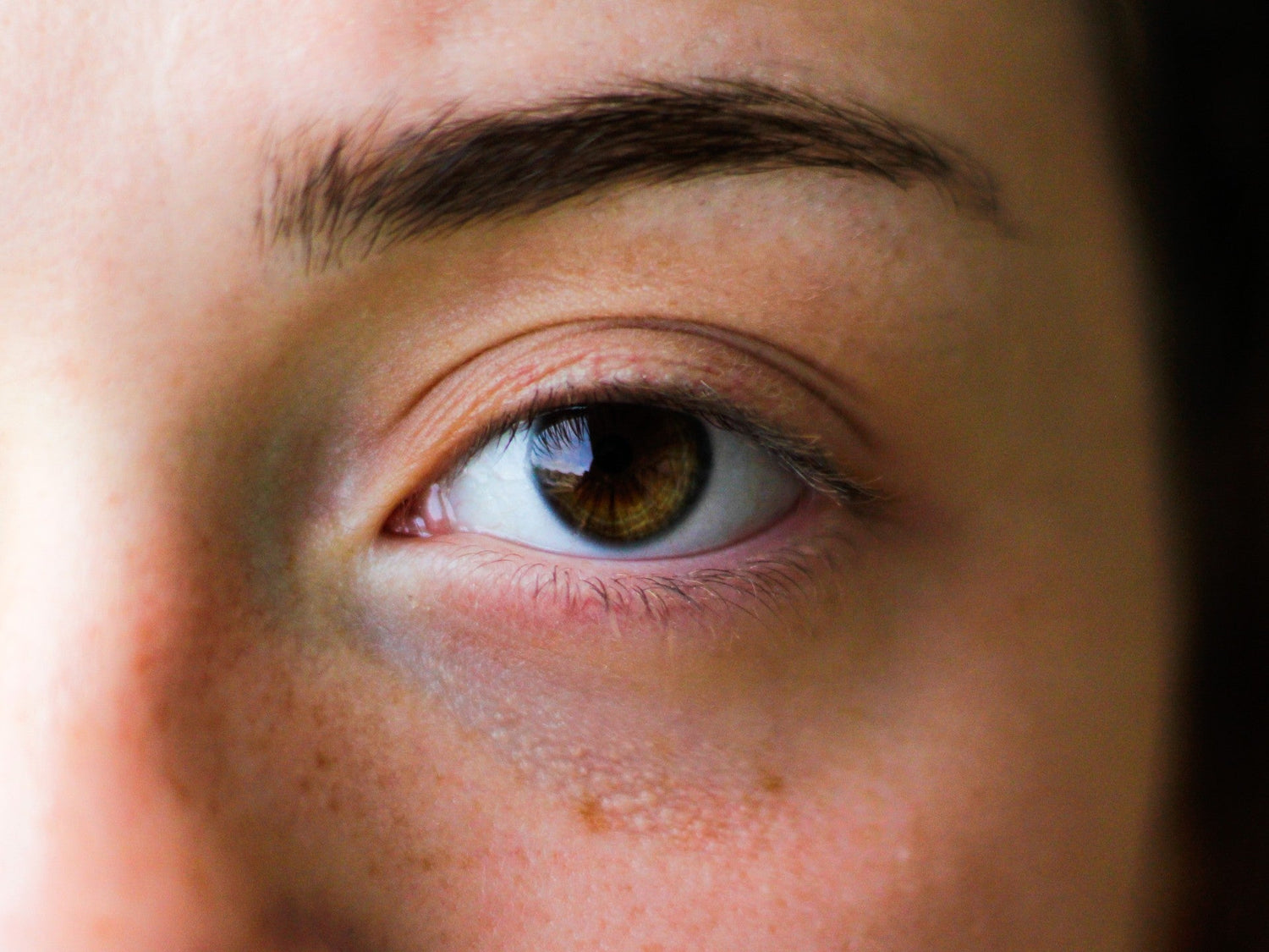 How to treat wrinkles, dark circles and bags under eyes with the EvenSkyn Venus - EVENSKYN® 