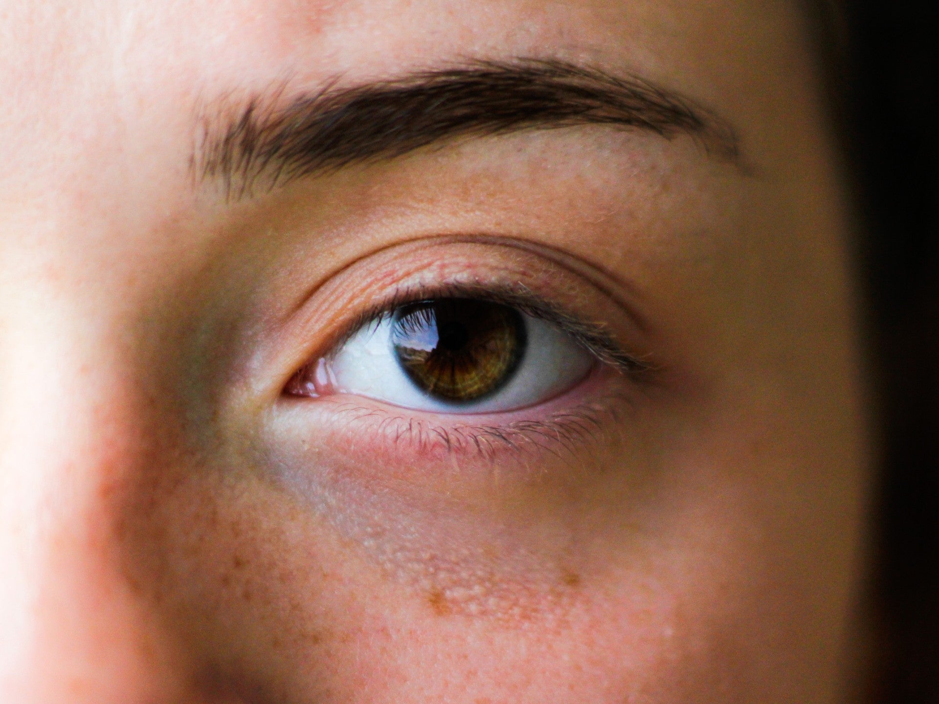 How to treat wrinkles, dark circles and bags under eyes with the EvenSkyn Venus - EVENSKYN® 
