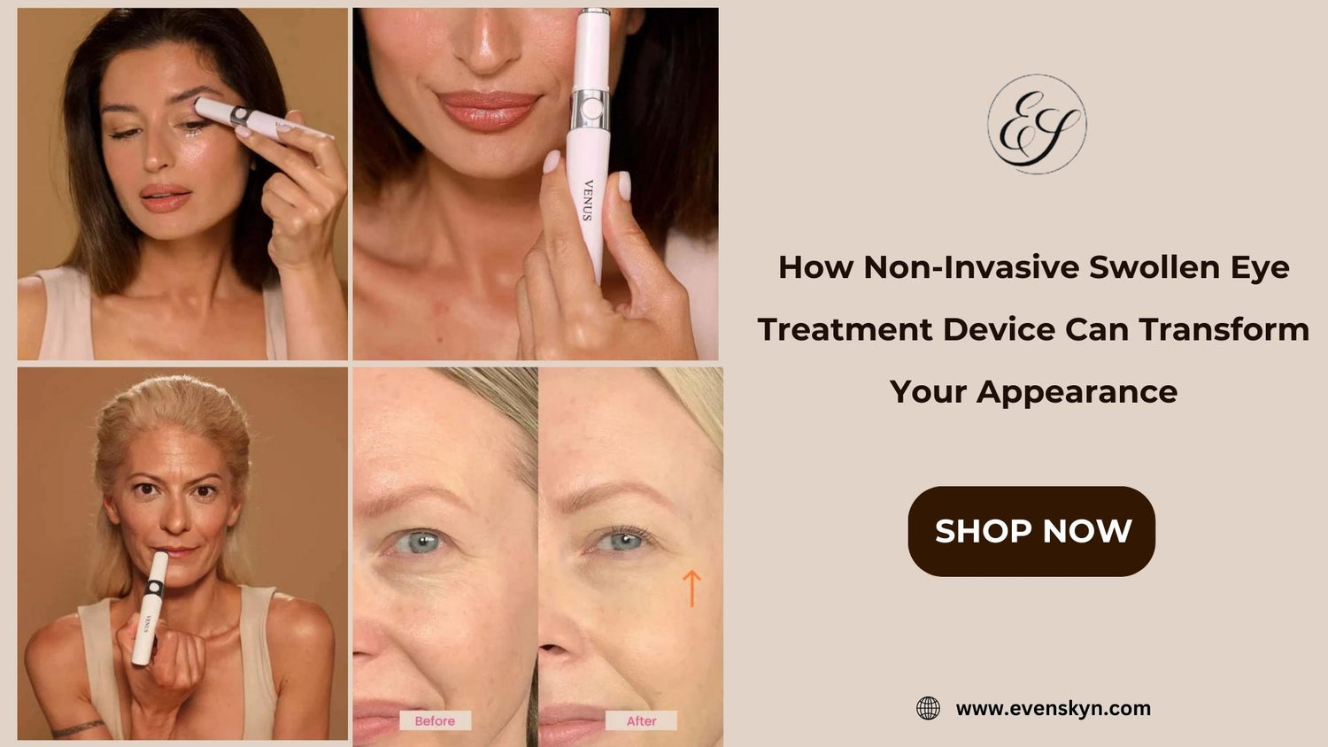 How Non-Invasive Swollen Eye Treatment Device Can Transform Your Appearance