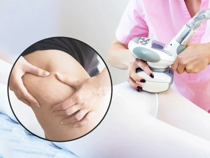 Maximising the Benefits of Ultrasound for At-Home Cellulite Reduction - EVENSKYN® 