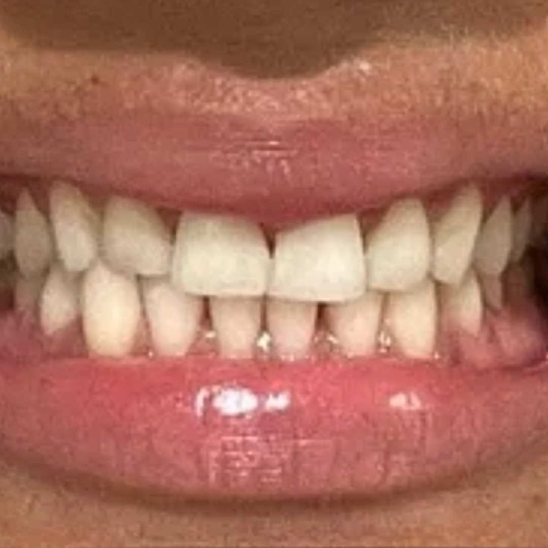 Before Image