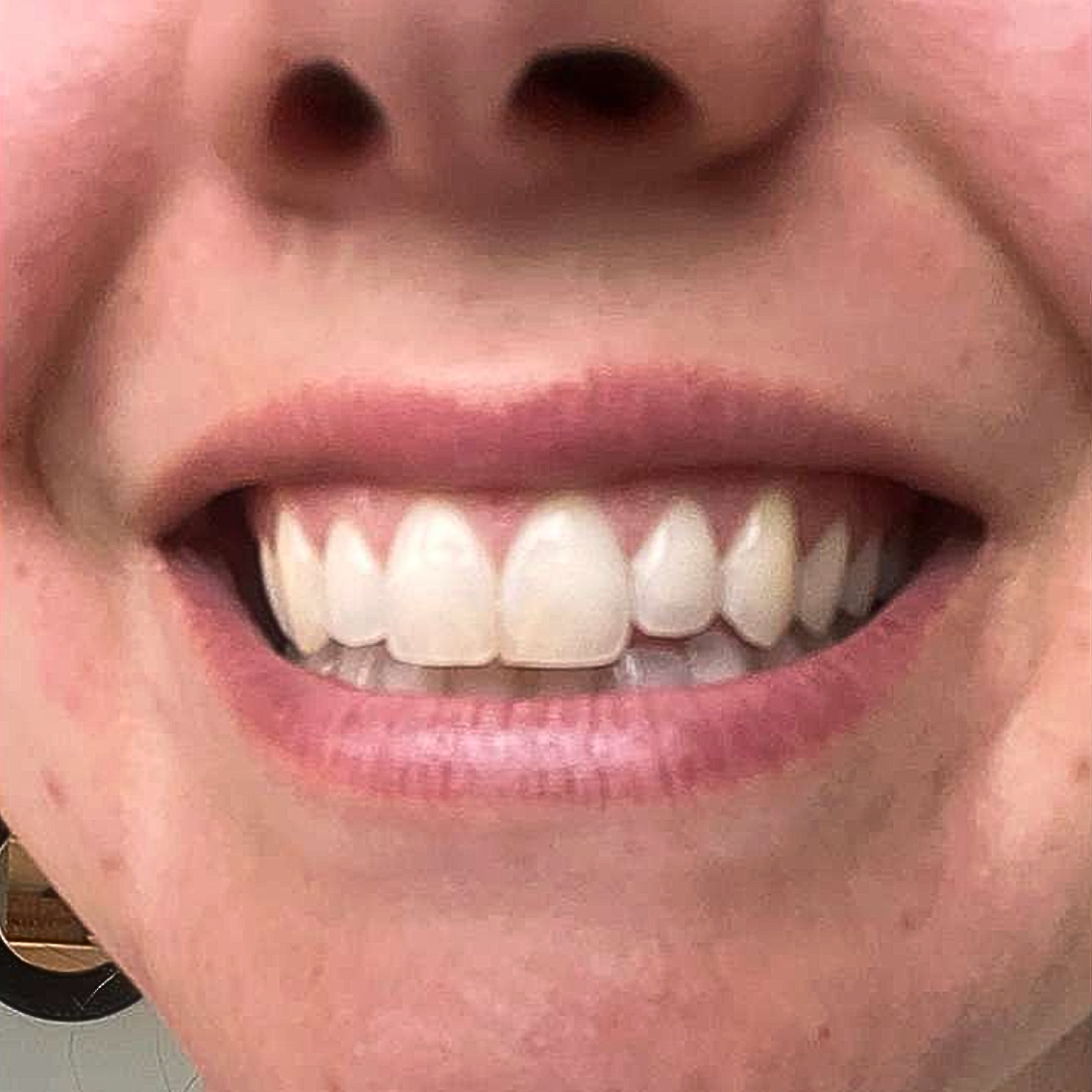 Before Image