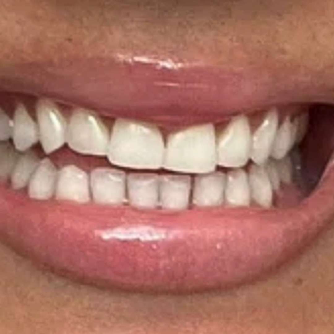 After Image