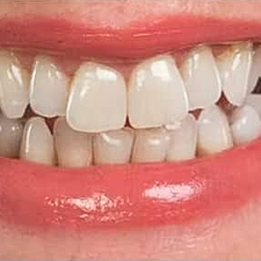 After Image