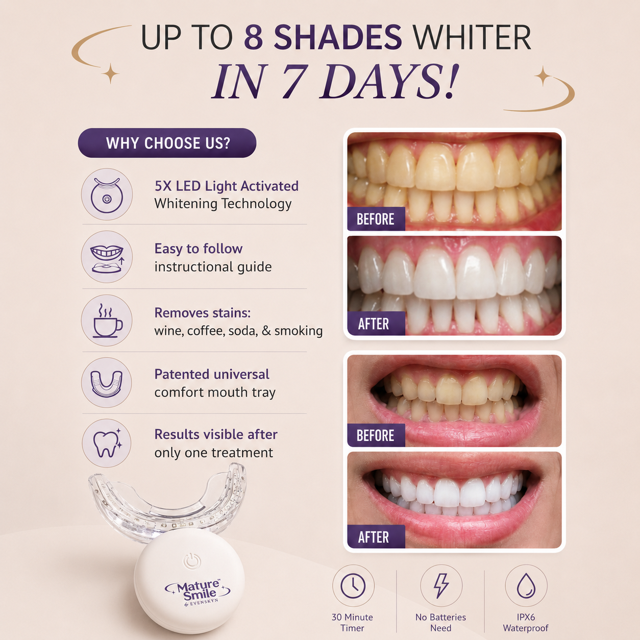 MatureSmile™ LED Teeth Whitening Kit for Sensitive & Mature Teeth | Enamel-Safe
