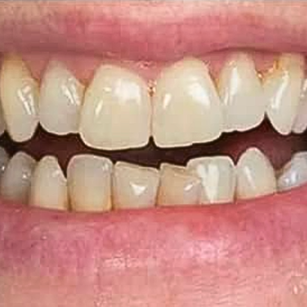 Before Image