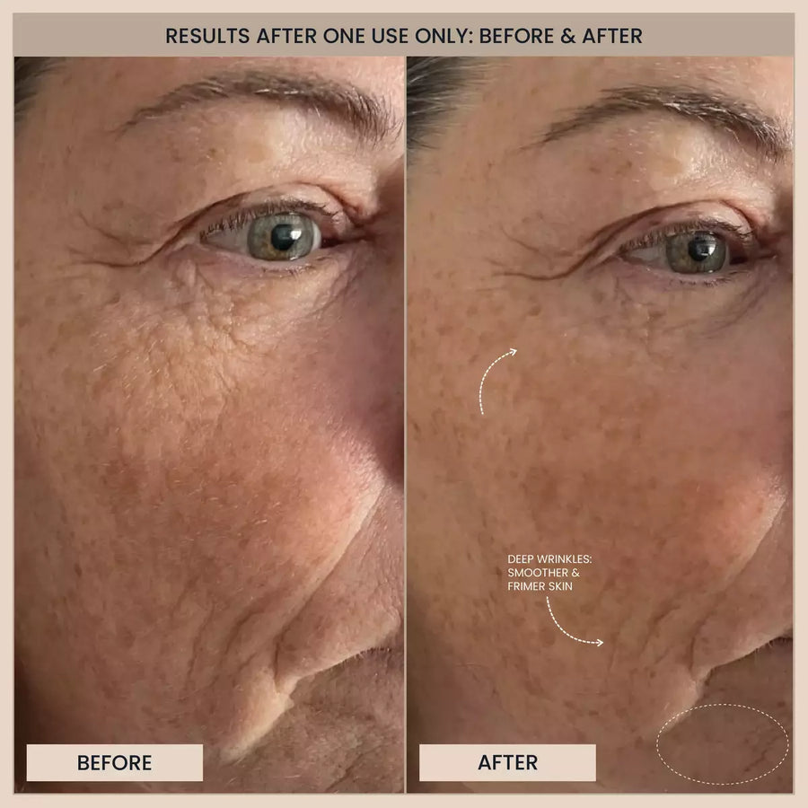Customer before and after photos of the eye area. A label is printed on the image.