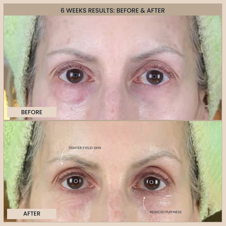 Customer before and after photos of the eyes. The image is labelled: 6 weeks results.