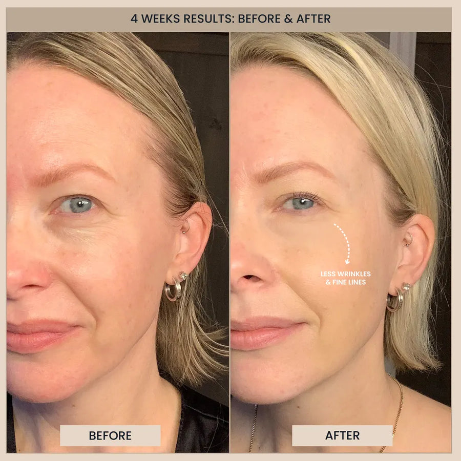 Customer before and after photos of the face. The image is labelled: 4 weeks results.
