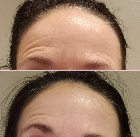 Stefanie H.’s own before and after, from a review of the Original Lumo