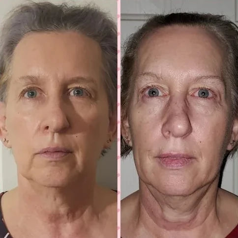 Shari R.’s own before and after, from a review of the Original Lumo