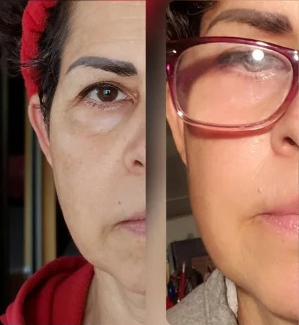 Doris R.’s own before and after, from a review of the Original Lumo