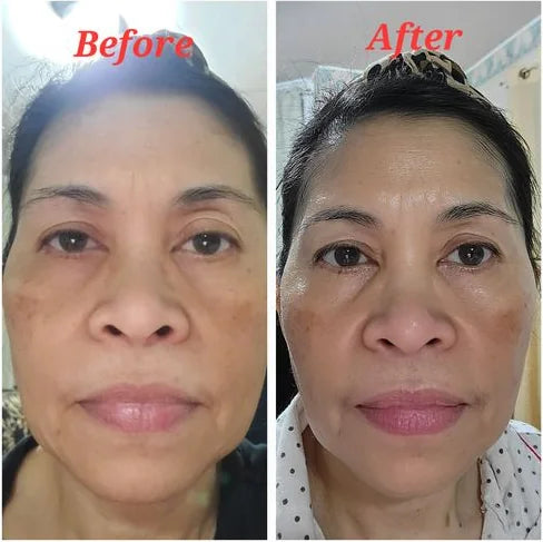 Meriam M.’s own before and after, from a review of the Original Lumo