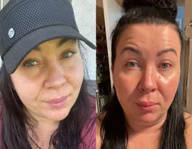 Nicole G.’s own before and after, from a review of the Original Lumo