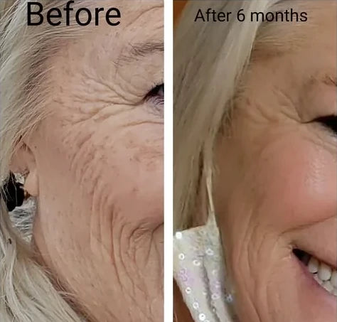 Cindy L.’s own before and after, from a review of the Original Lumo