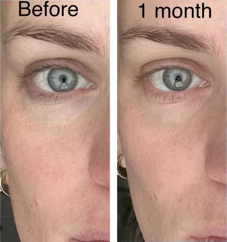 Jaclyn P.’s own before and after, from a review of the Original Lumo